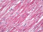 MNSOD / SOD2 Antibody